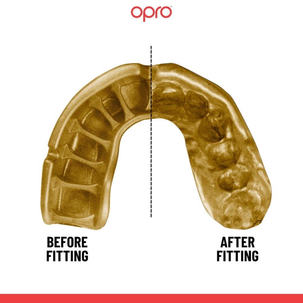 Opro Gold Self Fit Mouth Guard-FEUK