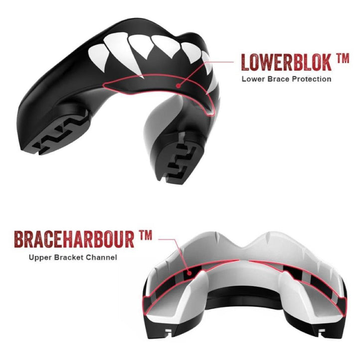 Safejawz Ortho Braces Mouth Guard-Safejawz